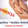 Pozbądź się cellulitu